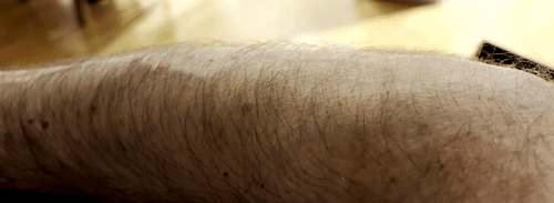 My arm getting goosebumps